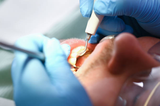 Best Weekend Emergency Dentist in Ishpeng, MI